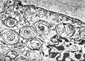 M,3m. | type II. pneumocyte M,3m. | type II. pneumocyte